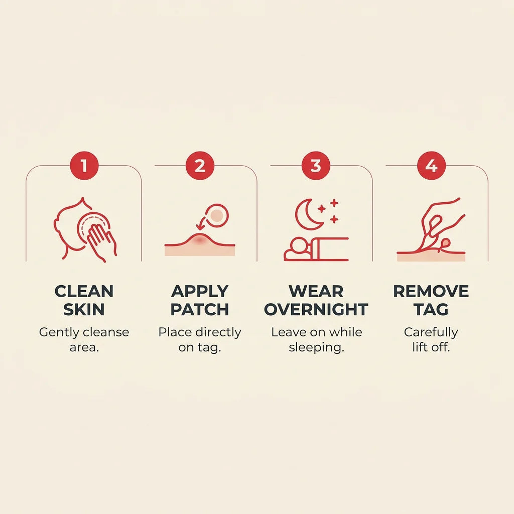BelBexa ClearTag Microneedle Skin Tag Patch (Buy 1 Get 1 FREE)